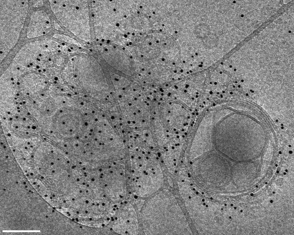 Cryo-TEM image of DOPS vesicles dispersion in PBS buffer (pH 7.4). These vesicles were prepared by sonication at room temperature, and were labeled in solution by biotinilated annexin V and 5 nm gold conjugated Streptavidin. Bar = 100 nm.